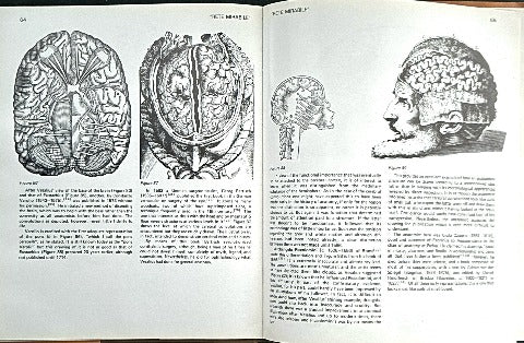 An Illustrated History of Brain Function